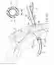 Fig. 25 - Articulating suturing device and method