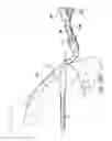 Fig. 32 - Articulating suturing device and method