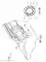 Fig. 35 - Articulating suturing device and method