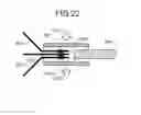 Fig. 13 - METHOD FOR MANUFACTURING TREATMENT TOOL AND TREATMENT TOOL
