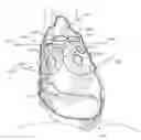 Fig. 01 - Methods of treating a cardiac arrhythmia by thoracoscopic production of a cox maze III lesion set