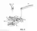 Fig. 09 - Surgical access system and related methods