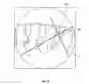 Fig. 28 - Surgical access system and related methods