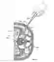 Fig. 30 - Surgical access system and related methods