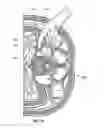 Fig. 32 - Surgical access system and related methods