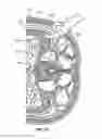 Fig. 33 - Surgical access system and related methods