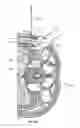 Fig. 35 - Surgical access system and related methods