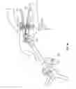 Fig. 45 - Surgical access system and related methods