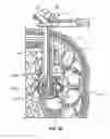 Fig. 49 - Surgical access system and related methods