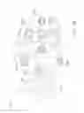 Fig. 14 - Retracting tissue