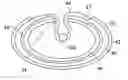 Fig. 01 - Expandable medical access sheath