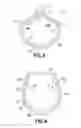 Fig. 03 - Expandable medical access sheath