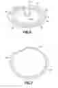 Fig. 05 - Expandable medical access sheath