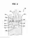Fig. 05 - Suture anchor with pulley