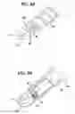 Fig. 10 - Suture anchor with pulley