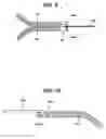 Fig. 13 - Suture anchor with pulley