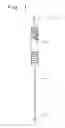 Fig. 02 - Single catheter heart repair device and method for use