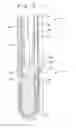 Fig. 07 - Single catheter heart repair device and method for use