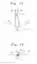 Fig. 13 - Single catheter heart repair device and method for use