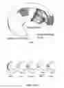 Fig. 05 - Suture passer with radiused upper jaw