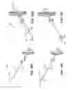 Fig. 09 - Suture passer with radiused upper jaw