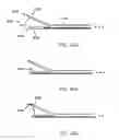 Fig. 21 - Suture passer with radiused upper jaw