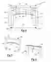 Fig. 03 - Orthopedic implant for bone fixation
