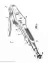 Fig. 02 - Anastomotic staple with capillary which expels a bonding agent upon deformation