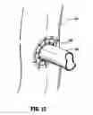 Fig. 09 - Anastomotic staple with capillary which expels a bonding agent upon deformation