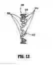 Fig. 10 - Anastomotic staple with capillary which expels a bonding agent upon deformation