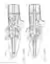 Fig. 138 - Drive train control arrangements for modular surgical instruments