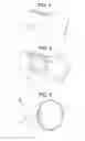 Fig. 03 - ADAPTOR WITH FLEXIBLE TIP COUPLED TO A WIRE NEEDLE FOR A CIRCULAR STAPLER OGIVAL TROCAR
