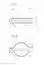 Fig. 05 - Embolic implant and method of use