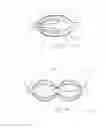Fig. 14 - Embolic implant and method of use