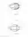 Fig. 15 - Embolic implant and method of use