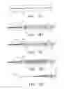 Fig. 05 - Venous insufficiency treatment method