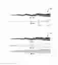 Fig. 08 - Precessional-motion bone and dental drilling tools and bone harvesting apparatus