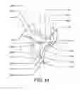 Fig. 14 - Precessional-motion bone and dental drilling tools and bone harvesting apparatus