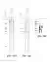 Fig. 25 - Precessional-motion bone and dental drilling tools and bone harvesting apparatus
