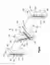 Fig. 16 - Surgical guide with cut resistant insert