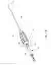 Fig. 16 - Microfracture apparatuses and methods