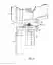 Fig. 04 - Bone resection guide and method