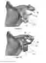 Fig. 06 - SHOULDER GUIDES