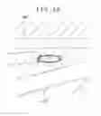 Fig. 27 - LIVING BODY INSERTION TOOL AND SUCTION METHOD