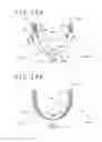 Fig. 29 - LIVING BODY INSERTION TOOL AND SUCTION METHOD