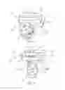 Fig. 02 - External fixation device