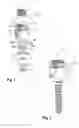 Fig. 02 - Polyaxial bone anchoring device
