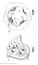 Fig. 11 - Highly-versatile variable-angle bone plate system