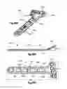 Fig. 32 - Highly-versatile variable-angle bone plate system