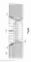 Fig. 37 - Highly-versatile variable-angle bone plate system